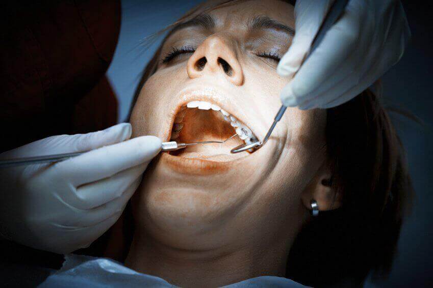 Have more than eight dental fillings?